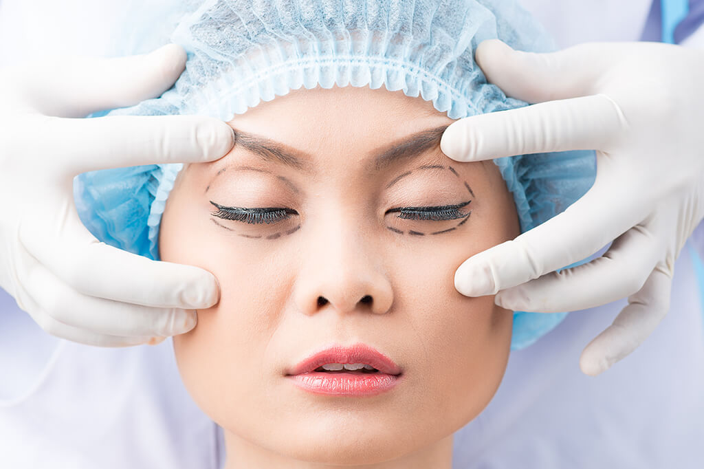Eyelid Surgery in Turkey