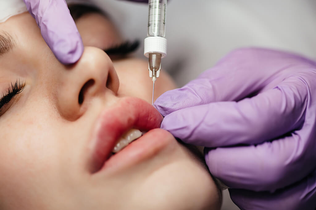 Lip Augmentation in Turkey