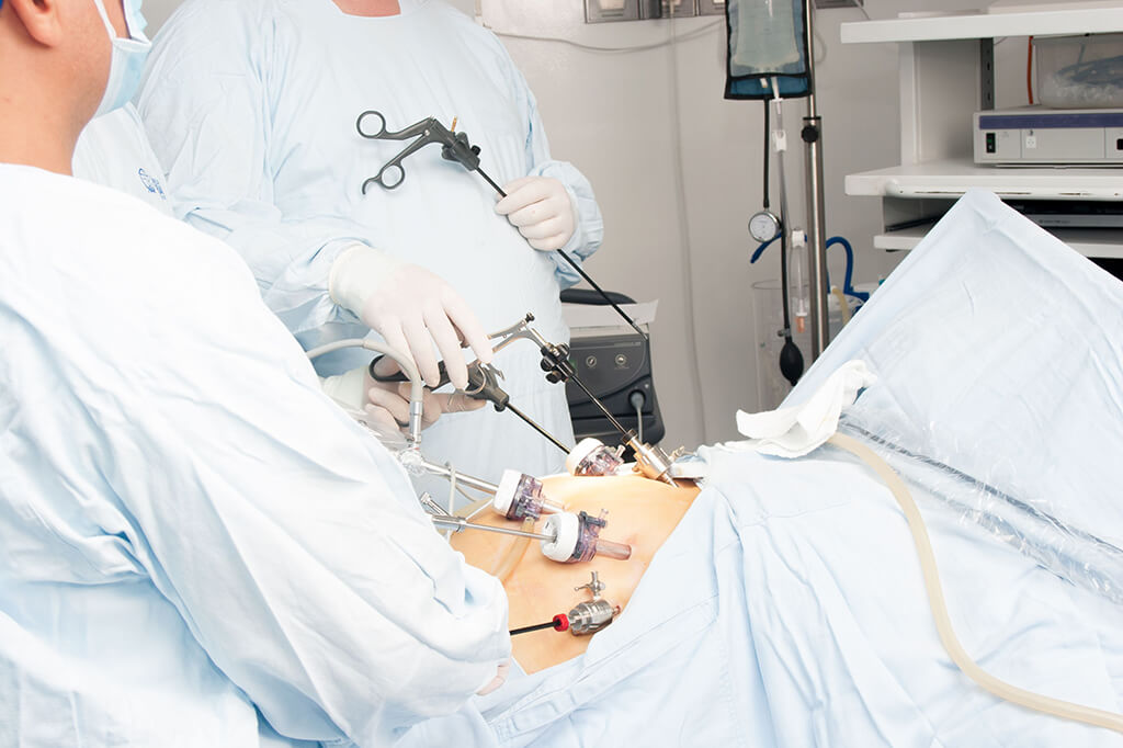 Gastric Bypass Surgery in Turkey